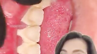 How to reduce dental calculus!