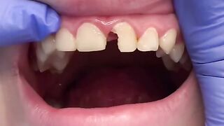 drmassidental - 6922245866388557062