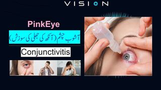 Eye Infection  آشوبِ چشم احتیاط اور علاج