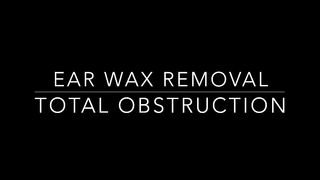 Total Obstruction Satisfying Earwax Removal
