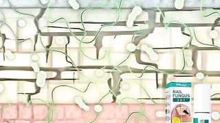 nail fungas remove