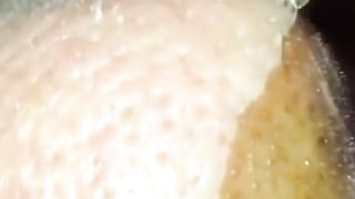 Satisfying Blackheads Removal Videos