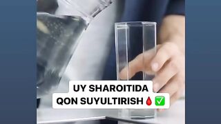 Уй шароитида