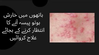 If your hands are itchy, get treatment instead of waiting for money