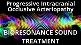 Progressive Intracranial Occlusive Arteriopathy_Sound therapy session_Sounds of nature