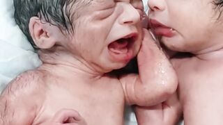 Preterm- twins- How -one baby sleep  and other tries to awake him with musical first cry