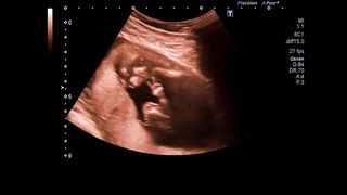 "Caring for Your Newborn Baby: Tips and Tricks"