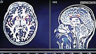 How to get rid of from  addiction