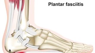 Planter facitius