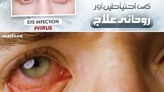 Eyes problem
