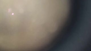 Discovery | Microscopic Marvels: Look What I Found! | TinyWorlds | FunFM
