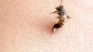 Why Bees Die After They Sting You ???? (ouch)