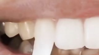 teeth whitener pen