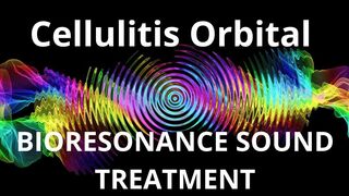 Cellulitis Orbital_Sound therapy session_Sounds of nature