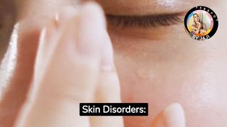 Common Skin Disorders
