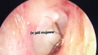 There's something scary inside the human ear