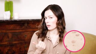DARK SPOT Treatment that really work, according to dermatologist