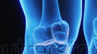 Joint pain foods|
