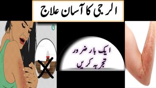 kharish ka ilaj | alerji ka ilaj|kharish ka wazifa