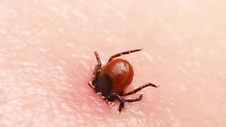 Congo virus /Congo virus symptom's/Congo virus treatments/Congo virus Pakistan alert/diagnosis congo