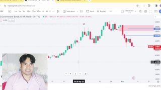 Xauusd Today Analysis || #Gold Today Analysis