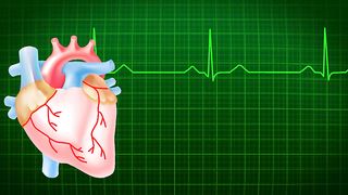 Heart ECG or EKG