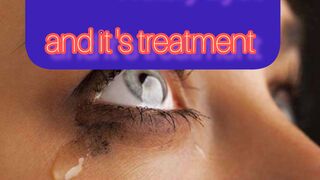 Watery Eyes and best treatment at home.