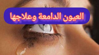 العيون الدامعة وعلاجها