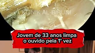 Adquira o Limpador ideal para seu ouvido tocando no