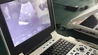 Echographie