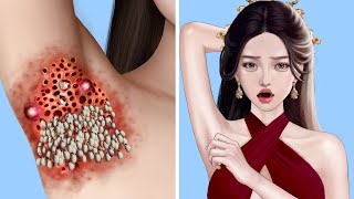 ASMR Removal Dog Ticks $ Maggot infected Armpit Severely injured Animation