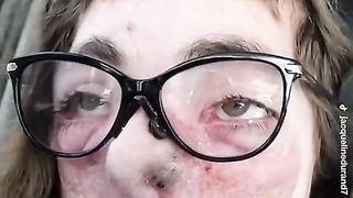 Dog attack