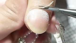 Check your nails