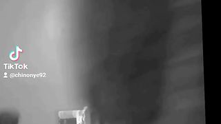 Abdominoperineal resection