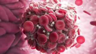 Did you know, 85% of all strokes are caused by blood clots?...  Credit: Helix Animation