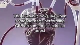 A good reason for EVERYONE to know CPR.