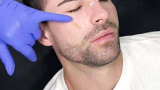 Skinpen + Hair Restoration with Plasma The secret to beauty!