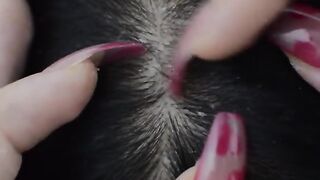 Asmr Nitpicking #asmr#viral