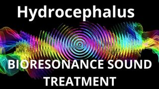 Hydrocephalus _ Sound therapy session _ Sounds of nature