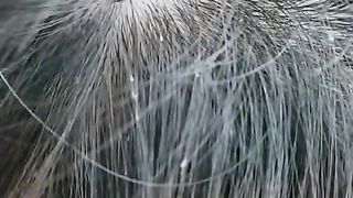 Hair lices remedy