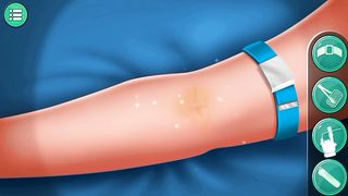 Appendix surgery