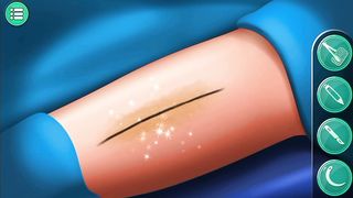 Leg surgery