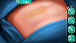 Stomach surgery