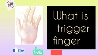 What is Trigger Finger? It's symptoms and treatment.