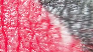 Tattoo under a Microscope
