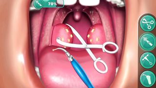 Tonsil surgery