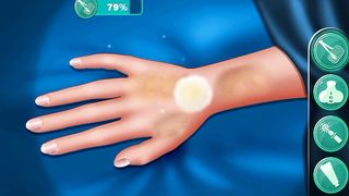 Burn treatment surgery