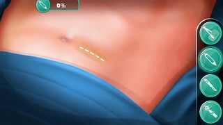 Kidney stone surgery