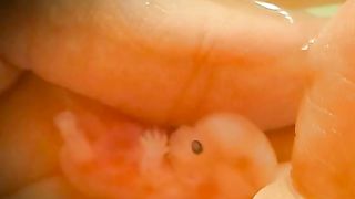 7_Weeks_to_10_Weeks_pregnancy_baby_abortions????#shorts#malayalam_#viral_#trending_#pregnancy(480p).