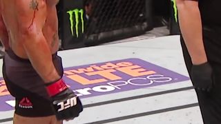 Robbie Lawler Went to WAR With Rory MacDonald - UFC - MMA